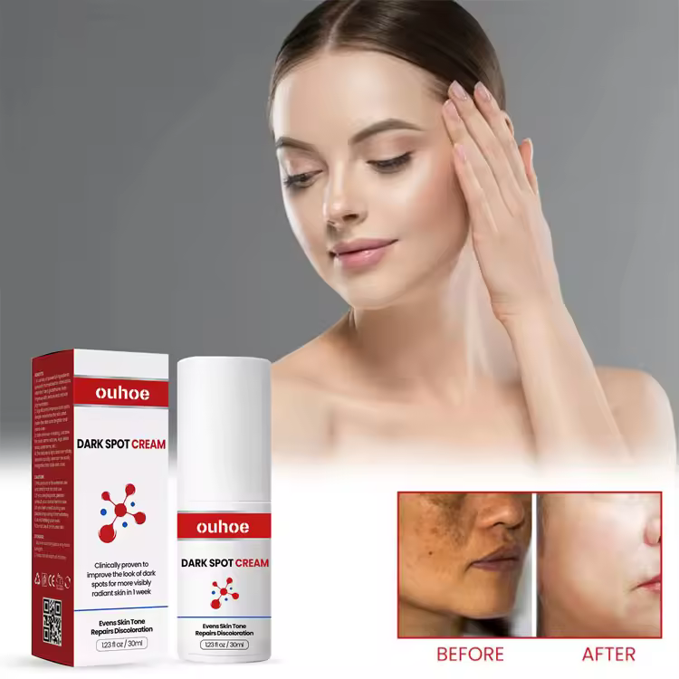 Dark Spots Repair Cream